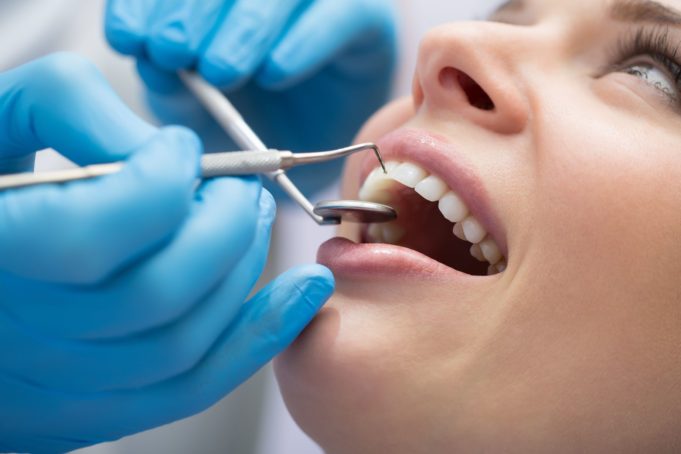 DM_il-dentista-moderno_classificazione-malattia-parodontale-681x454