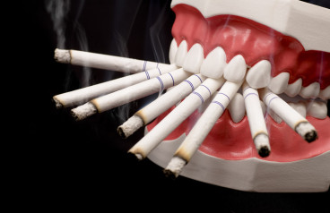 smoking-is-injurious-to-your-teeth
